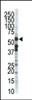 Antibody is used in Western blot to detect ZMPSTE24 in T-47D cell lysate.