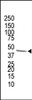 Antibody is used in Western blot to detect FDPS in human cytokeratin liver cell lysate. Data is kindly provided by Dr. Masaru Harada from Stanford University (Palo Alto, CA) .