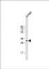 Western Blot at 1:1000 dilution + Jurkat whole cell lysate Lysates/proteins at 20 ug per lane.