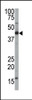 Antibody is used in Western blot to detect FNTA in mouse brain tissue lysate.