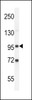 Western blot analysis in K562 cell line lysates (35ug/lane) .This demonstrates the GPLD2 antibody detected the GPLD2 protein (arrow) .