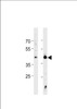 Western blot analysis in Jurkat cell line and mouse heart tissue lysates (35ug/lane) .