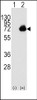 Western blot analysis of ACOX1 using rabbit polyclonal ACOX1 Antibody using 293 cell lysates (2 ug/lane) either nontransfected (Lane 1) or transiently transfected with the ACOX1 gene (Lane 2) .