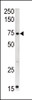 Western blot analysis of anti-CPT2 Pab in mouse kidney tissue lysate (35ug/lane)