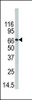 Western blot analysis of anti-PAD4 Pab in 293 cell line lysate