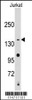 Western blot analysis of anti-SMC2 Antibody in Jurkat cell line lysates (35ug/lane)