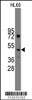 Western blot analysis of anti-Ihh Pab in HL60 cell line lysates (35ug/lane)