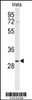 Western blot analysis of PHB Antibody in Hela cell line lysates (35ug/lane)