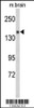 Western blot analysis of Semaphorin 5A-S106 Antibodyin mouse brain tissue lysates (35ug/lane) .