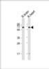 Western Blot at 1:1000 dilution Lane 1: rat brain lysate Lane 2: rat heart lysate Lysates/proteins at 20 ug per lane.