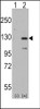 Western blot analysis of DAAM1 using rabbit polyclonal DAAM1 Antibody (Human N-term) using 293 cell lysates (2 ug/lane) either nontransfected (Lane 1) or transiently transfected with the DAAM1 gene (Lane 2) .