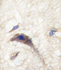 Formalin-fixed and paraffin-embedded human brain tissue reacted with DAAM1 Antibody, which was peroxidase-conjugated to the secondary antibody, followed by DAB staining.