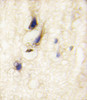 Formalin-fixed and paraffin-embedded human brain tissue reacted with DAAM1 Antibody, which was peroxidase-conjugated to the secondary antibody, followed by DAB staining.