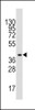 Western blot analysis of anti-ALDOA Antibody in mouse liver tissue lysates (35ug/lane) .