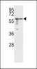 Western blot analysis of Vimentin Antibody in A2058, A375 cell line lysates (35ug/lane)