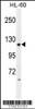 Western blot analysis in HL-60 cell line lysates (35ug/lane) .This demonstrates the LGR5/GPR49 antibody detected the LGR5/GPR49 protein (arrow) .