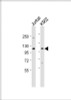 Western Blot at 1:1000 dilution Lane 1: Jurkat whole cell lysate Lane 2: K562 whole cell lysate Lysates/proteins at 20 ug per lane.