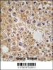 Formalin-fixed and paraffin-embedded human testis tissue reacted with M6PR antibody, which was peroxidase-conjugated to the secondary antibody, followed by DAB staining.