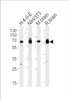 Western blot analysis of lysates from H-4-II-E, mouse NIH/3T3 cell line, mouse brain and rat brain tissues (from left to right) , using STIP1 Antibody at 1:1000 at each lane.