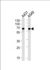 Western blot analysis in A431, A549 cell line lysates (35ug/lane) .