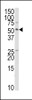 Western blot analysis of anti-TRAIP Antibody in HepG2 cell line lysates (35ug/lane) .