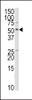 Western blot analysis of anti-TRAIP Antibody in HepG2 cell line lysates (35ug/lane) .