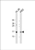 Western Blot at 1:1000 dilution Lane 1: HL-60 whole cell lysate Lane 2: K562 whole cell lysate Lysates/proteins at 20 ug per lane.