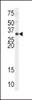 Western blot analysis of anti-APEX1 Antibody in Hela cell line lysates (35ug/lane)