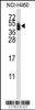 Western blot analysis of anti-CXADR Antibody in NCI-H460 cell line lysates (35ug/lane) .