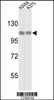 Western blot analysis of HSPH1 Antibody in A2058 and A375 cell line lysates (35ug/lane)