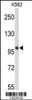 Western blot analysis of HSPH1 Antibody in K562 cell line lysates (35ug/lane)