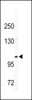 Western blot analysis of CD49e antibody in mouse bladder tissue lysates (35ug/lane)