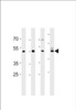 Western blot analysis in U251, mouse C2C12, mouse NIH/3T3 cell line and mouse brain tissue lysates (35ug/lane) .