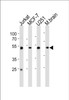 Western blot analysis in Jurkat, MCF-7, U251 cell line and mouse brain tissue lysates (35ug/lane) .
