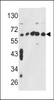 Western blot analysis of CCT3 Antibody in MCF7, CEM, K562, HL-60, Hela cell line lysates (35ug/lane)