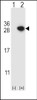 Western blot analysis of ARHGDIA using rabbit polyclonal ARHGDIA Antibody using 293 cell lysates (2 ug/lane) either nontransfected (Lane 1) or transiently transfected (Lane 2) with the ARHGDIA gene.