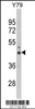 Western blot analysis of PSMD13 Antibody in Y79 cell line lysates (35ug/lane)