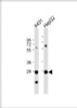 Western Blot at 1:1000 dilution Lane 1: A431 whole cell lysate Lane 2: HepG2 whole cell lysate Lysates/proteins at 20 ug per lane.