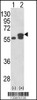 Western blot analysis of PDIA3 using rabbit polyclonal PDIA3 Antibody using 293 cell lysates (2 ug/lane) either nontransfected (Lane 1) or transiently transfected with the PDIA3 gene (Lane 2) .