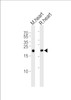 Western blot analysis of lysates from mouse heart and rat heart tissue lysate (from left to right) , using PRDX2 Antibody at 1:1000 at each lane.