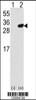 Western blot analysis of PRDX6 using rabbit polyclonal PRDX6 Antibody using 293 cell lysates (2 ug/lane) either nontransfected (Lane 1) or transiently transfected with the PRDX6 gene (Lane 2) .