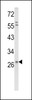 Western blot analysis of in HepG2 cell line lysates (35ug/lane)