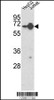 Western blot analysis of HNRPL Antibody in HepG2, Jurkat cell line lysates (35ug/lane)