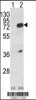 Western blot analysis of HNRPL using rabbit polyclonal HNRPL Antibody using 293 cell lysates (2 ug/lane) either nontransfected (Lane 1) or transiently transfected with the HNRPL gene (Lane 2) .