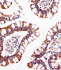 Immunohistochemical analysis of paraffin-embedded H. small intestine section using ATP5B Antibody . Antibody was diluted at 1:25 dilution. A undiluted biotinylated goat polyvalent antibody was used as the secondary, followed by DAB staining.