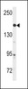 Western blot analysis of anti-ABL Antibody (Y251) in A2058 cell line lysates (35ug/lane)