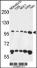 Western blot analysis in MDA-MB435, CEM, MCF-7, Jurkat, Hela cell line lysates (35ug/lane) .This demonstrates the ANKFY1 antibody detected the ANKFY1 protein (arrow) .