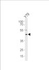 Western blot analysis in Y79 cell line lysates (35ug/lane) .