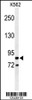 Western blot analysis of AVIL Antibody in K562 cell line lysates (35ug/lane)
