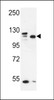 Western blot analysis in MDA-MB435, MCF-7 cell line lysates (35ug/lane) .